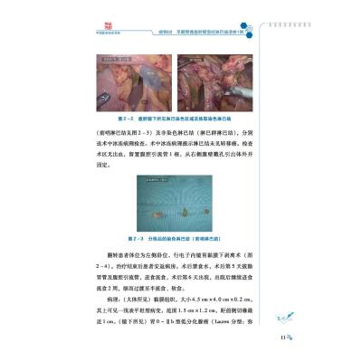 中国医学科学院肿瘤医院胃癌病例精解