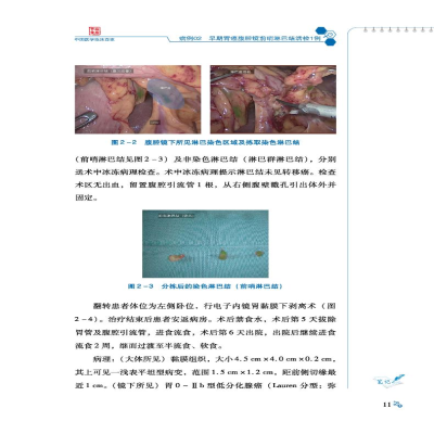 [M]中国医学科学院肿瘤医院胃癌病例精解-9787518986392