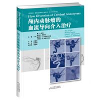 [N]颅内动脉瘤的血流导向介入治疗(精)-9787543341272
