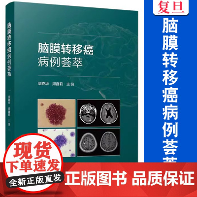 脑膜转移癌病例荟萃 梁晓华,周鑫莉主编 复旦大学出版社 脑膜瘤病案汇编