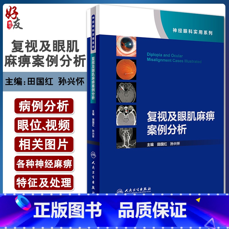[正版]复视及眼肌麻痹案例分析神经眼科实用系列 田国红孙兴怀 眼科学视神经疾病看图识病疑难杂症罕见病例人民卫生出版社眼