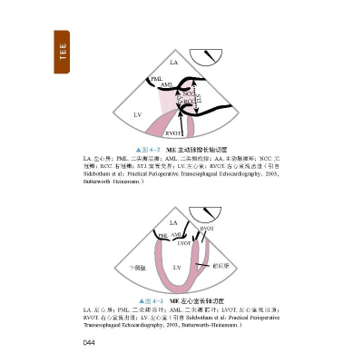 正版新书]TEE掌中宝 原书第2版(美)莱恩·格罗班,(美)钱德里卡·拉