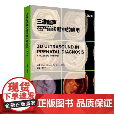 三维超声在产前诊断中的应用(第2版)