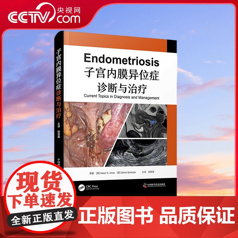 [央视网]子宫内膜异位症诊断与治疗 一部聚焦内异症的临床诊治 展示循证证据和实践经验的实用著作 ZK