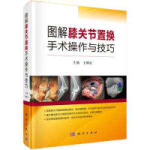 醉染图书图解膝关节置换手术操作与技巧9787030616418