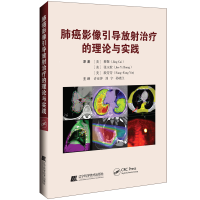音像肺癌影像引导放治疗的理论与实践蔡敬(美)