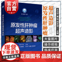 原发性肝肿瘤超声造影 东方超声文库上海科学技术出版社复旦大学附属中山医院超声科多年经验经典病例凝集肿瘤学