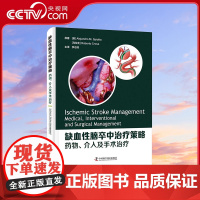 [央视网]缺血性脑卒中治疗策略 药物 介入及手术治疗 ZK