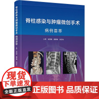 脊柱感染与肿瘤微创手术病例荟萃 张西峰,虞攀峰,张泽华 编 科学技术文献出版社 外科 外科学