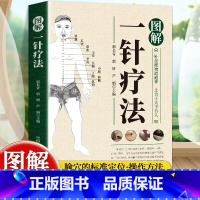 图解一针疗法 [正版]图解一针疗法 针虽细物道通神 上合于天下合人 中医学教程书籍 针灸疗法穴位中医临床腧穴定位操作方法