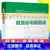 [正版] 疑难心电图图谱 刘霞 编著 上海科学技术出版社 9787547805237 收集210例在诊断上有难度的心电