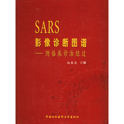正版新书]SARS影像诊断图谱:附临床诊治经过赵春惠 梁连春97878