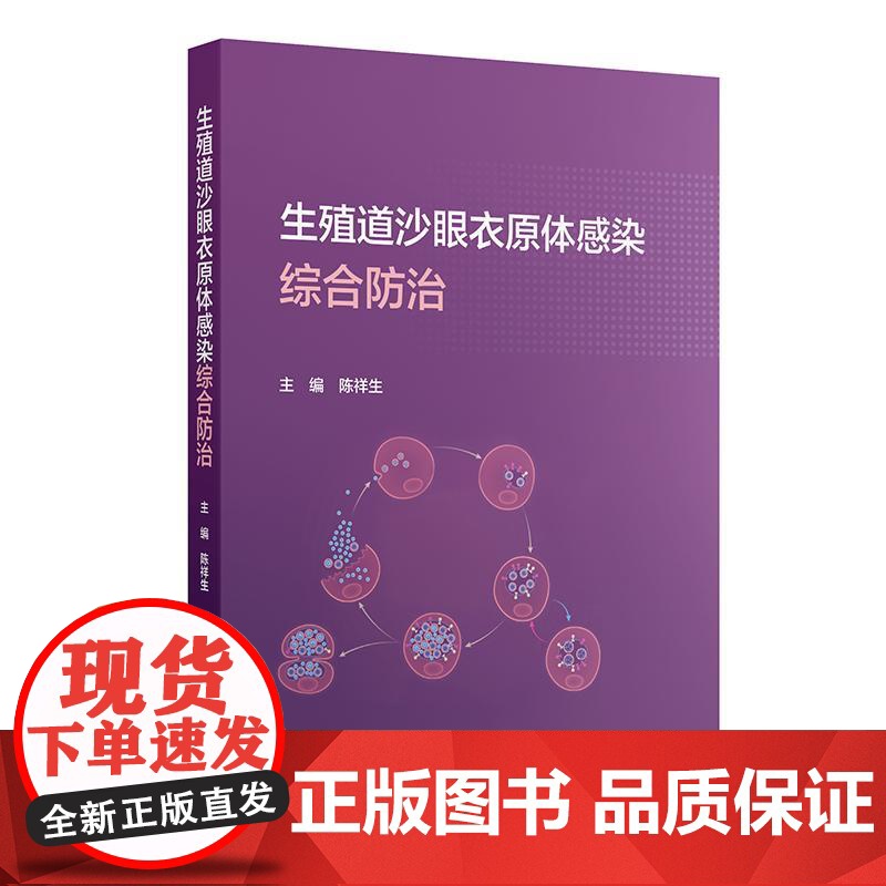 生殖道沙眼衣原体感染综合防治