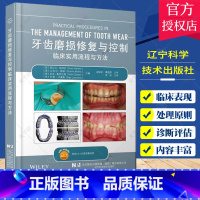 单本全册 [正版]牙齿磨损修复与控制 临床实用流程与方法 周炜 局部和大范围磨损及牙列缺损伴磨耗患者的诊疗计划制订等 辽