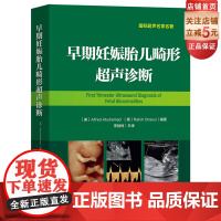 早期妊娠胎儿畸形超声诊断(李胜利主译 早孕期胎儿畸形超声诊断书)