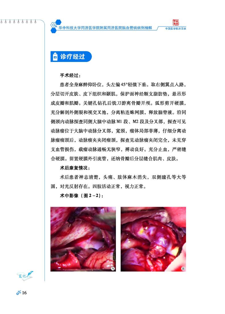 华中科技大学同济医学院附属同济医院脑血管病病例精解