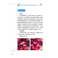 华中科技大学同济医学院附属同济医院脑血管病病例精解