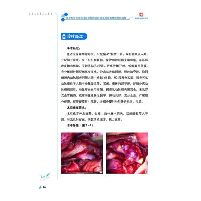 华中科技大学同济医学院附属同济医院脑血管病病例精解