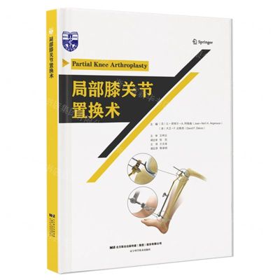 [N]局部膝关节置换术(精)-9787559124395
