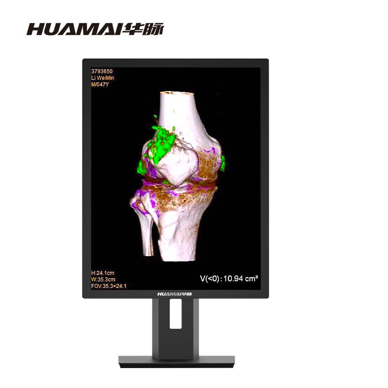 华脉(HUAMAI)医用显示器 全彩21.3英寸3MP 影像诊断 阅片显示屏1100cd/㎡亮 HM-S32C0