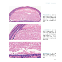 [M]皮肤病病例精粹——从临床到病理 第2辑-9787565926228