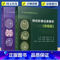 [正版] 神经影像征象解析 非肿瘤篇+肿瘤篇 医学影像联盟JD丛书 王宇军等主编 肿瘤性与非肿瘤性病变的影像学诊 科学