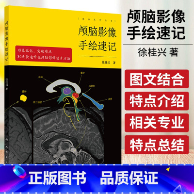 颅脑影像手绘速记 徐桂兴著 人民卫生出版社 脑血管病 动脉瘤性蛛网膜下腔出血 颅内病变综合阅片汇总 脱髓鞘 [正版]颅脑