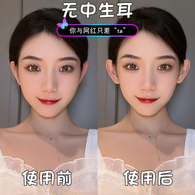 无耳洞精灵耳贴神器招风立耳贴女固定贴显脸小拍照矫正支撑器硅胶送女朋友老婆情人节七夕生日礼物