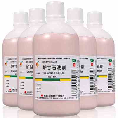 [5瓶装,买即送棉签1袋]信龙 炉甘石洗剂 100ml皮炎湿疹瘙痒痱子皮肤病洗液液体剂