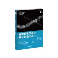 [N]视网膜光学相干断层扫描图谱(精)-9787543340701