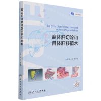 [N]离体肝切除和自体肝移植术(精)-9787117313384