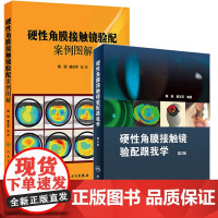 硬性角膜接触镜验配跟我学第二版梅颖眼科学验光师套装角膜地形图眼科书籍眼镜设备验光配镜书视光学眼视光器械学角膜屈光角膜镜