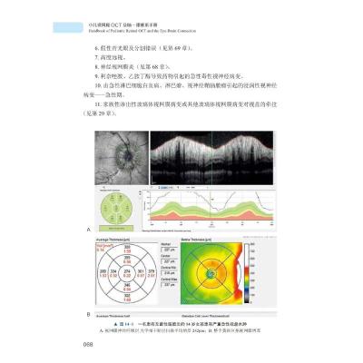 小儿视网膜OCT及脑-眼联系手册