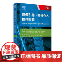 影像引导下脊柱介入操作图解 第2二版 毕胜 译 第2版以高度可视化的图解形式展示了各种介入操作技术 9787117373